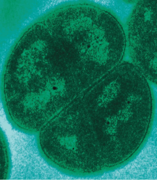 Mostrar a bactéria Deinococcus radiodurans, um micro-organismo extremófilo.